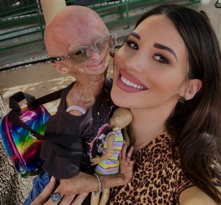 Adalia Rose Father Ryan Pallante And Mother Natalie Pallante – Are They Her Biological Parents?