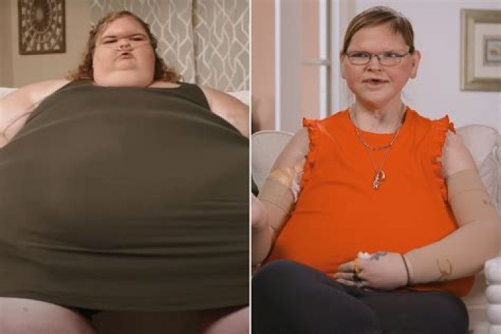 Amy Stran Weight Loss Journey