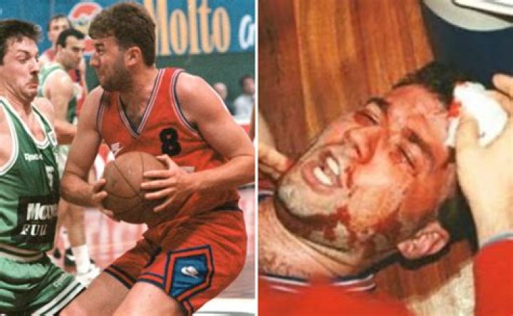 Boban Jankovic Injury Video Taking Over The Internet- What Happened To The Serbian Basketballer?