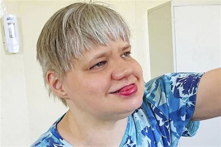 
Cheryl Yewdall, Care home Resident, Dies at 50 