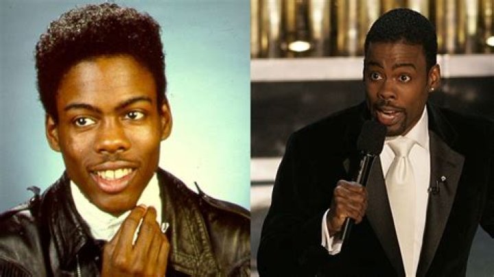 Chris Rock’s Plastic Surgery: Before and After Face Surgery in 2022!