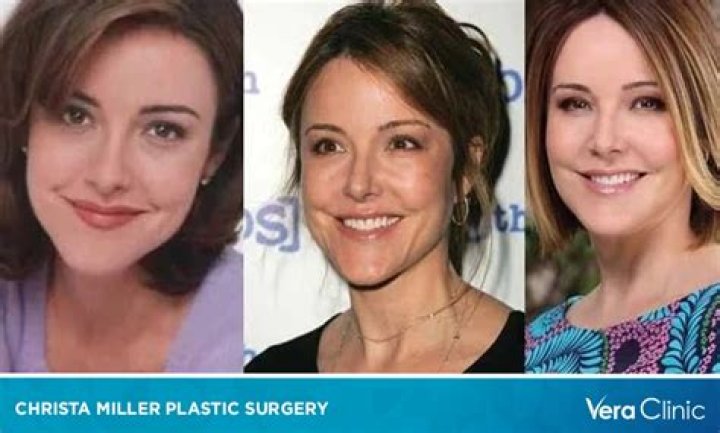 Christa Miller Plastic Surgery: What Happened To Her Face In Head Of the Class?