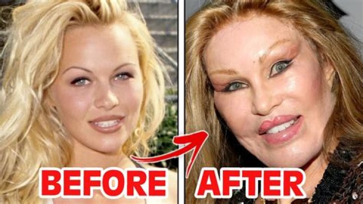 Clarissa Ward Surgery History, Did She Undergo Face Lift? Fans Are Confused