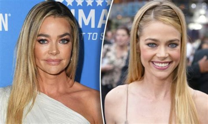 Denise Richards Before Plastic Surgery! Who Is Denise Richards? Denise Richards Wikipedia, Age, Height, Husband, And Net Worth