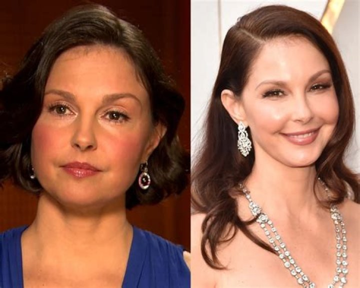 Did Ashley Judd Get A Face Lift Surgery? Before And After Photos