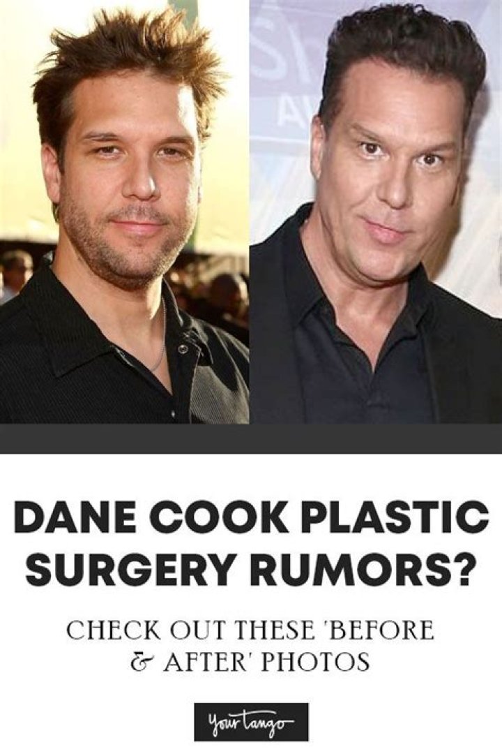 Did Dane Cook Undergo Plastic Surgery? What Happened To His Face? Before and After Photos