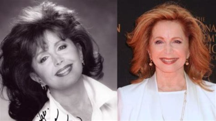 Did Suzanne Rogers Have Plastic Surgery for Face Lift? Illness Explained