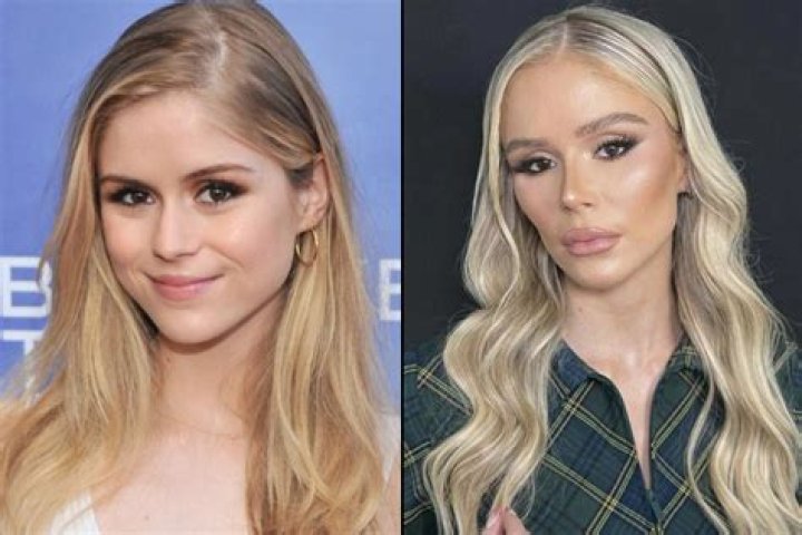 Emma Hernan’s Plastic Surgery: Her Secret to Younger Appearance? Is It Makeup?