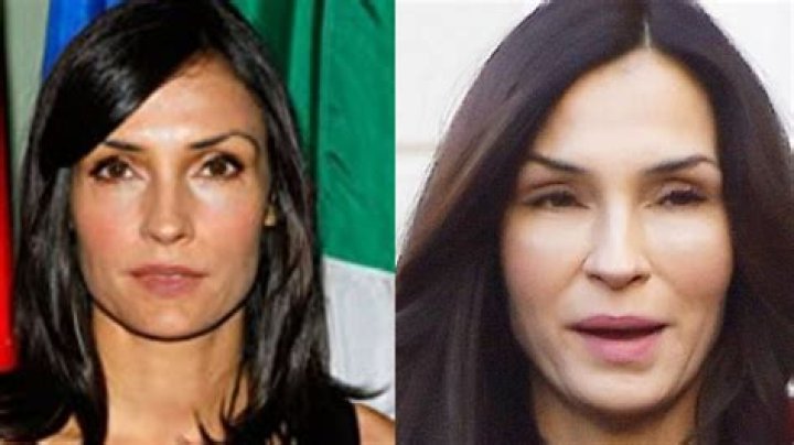 Famke Janssen’s Plastic Surgery: Did The Poison Rose Cast Have Botox, Fillers, and a Facelift as Fans Claim? Look at the Before and After Pictures!