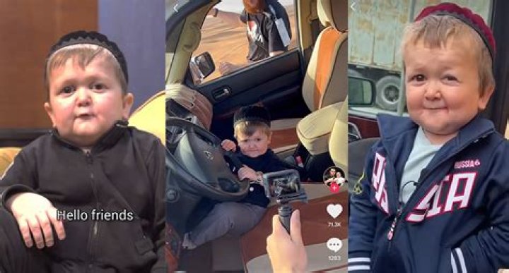 Hasbulla Disability: What Condition Does Mini Khabib Have?