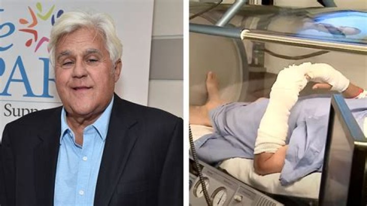 How did Jay Leno’s accident happen?