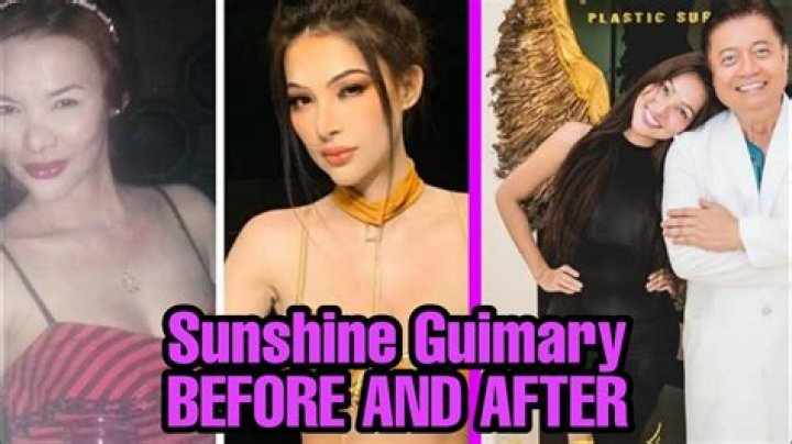How Much Make Over Has Sunshine Guimary Done Explore Before Plastic Surgery Photos Of Beauty!