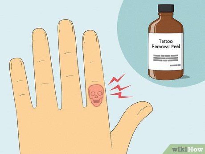 How to get rid of a stick and poke