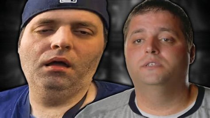 Is ONLYUSEmeBLADE Dead? His Leg Sores And Teeth Update & Girlfriend Becky