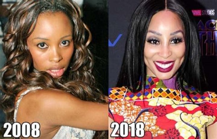 Khanyi Mbau Before And After Plastic Surgery, Age Height And Body Measurements