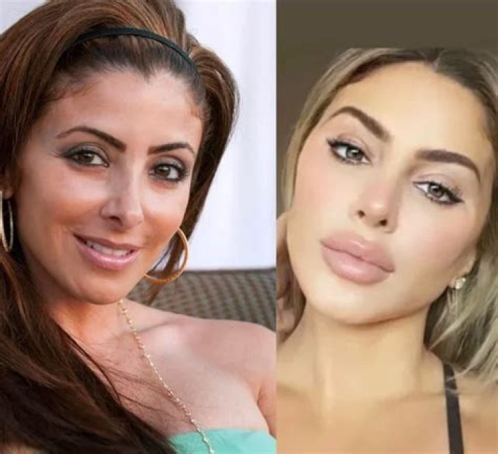 Larsa Pippen Before And After Looks: The Real Housewives Star Seems To Have Gotten A Cosmetic Surgery