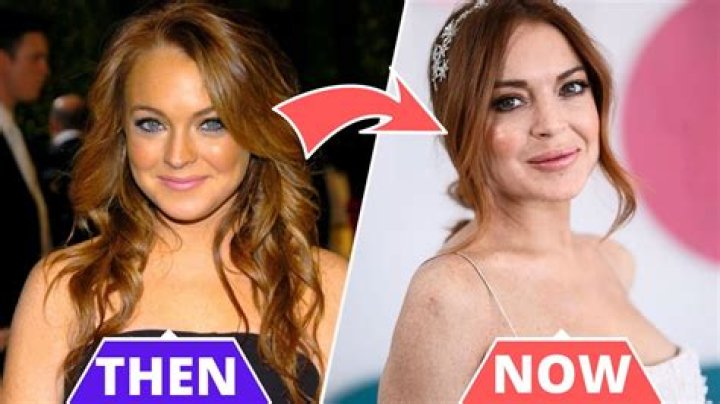 Lindsay Lohan’s Plastic Surgery: Fillers, Nose Job, Eye Lift & More!