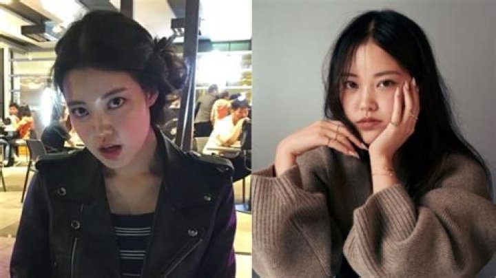 Michelle Choi’s Plastic Surgery: Reddit Users Believe the 28-Year-Old Star Might Have Had Some Works Done!