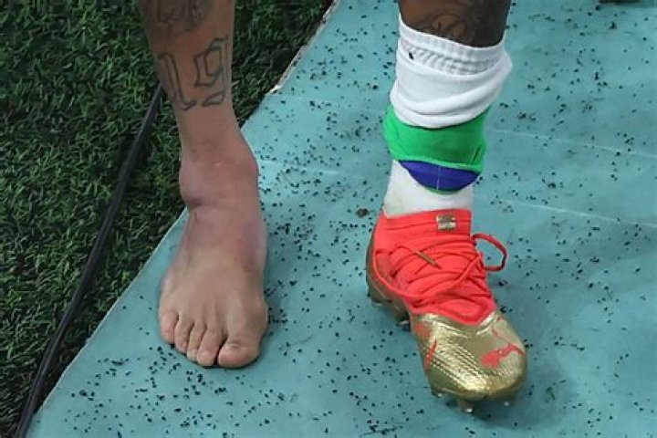 Neymar Jr Swollen Ankle: Is He Out of World Cup Or Will Be Playing Next Game?