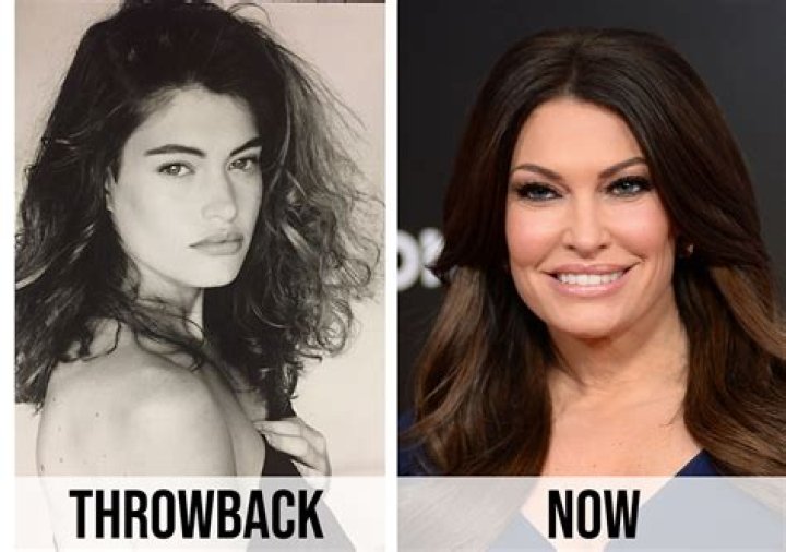 Ornella Vanoni Plastic Surgery Transformation Over The Years