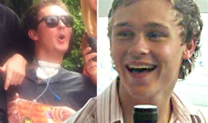 Reddit Discusses The Case Of Rugby Player Sam Ballard Who Died Of A Slug