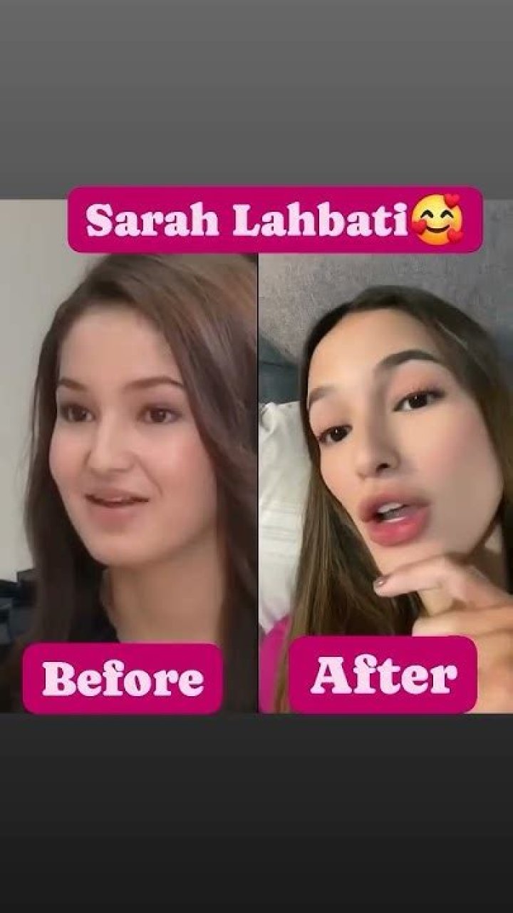 Sarah Lahbati Before And After: Surgery Transformation 2023
