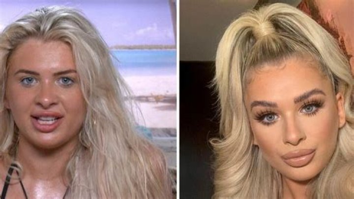 What Did Liberty Poole Look Like Before Surgery? Pictures With Mum Jo On Instagram