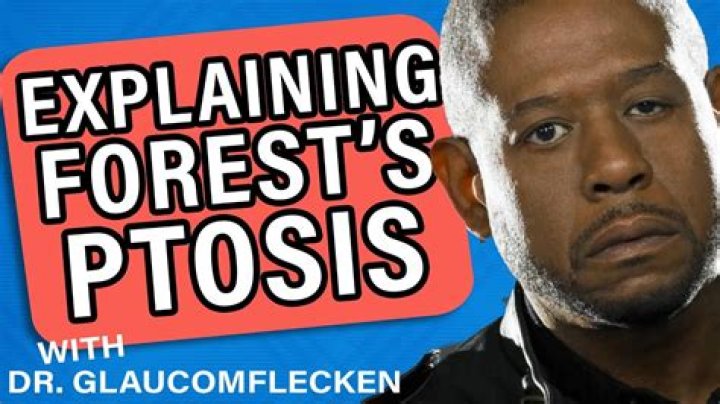 What Happened To Forest Whitaker Left Eye, Does He Have Ptosis – Lazy Eye?