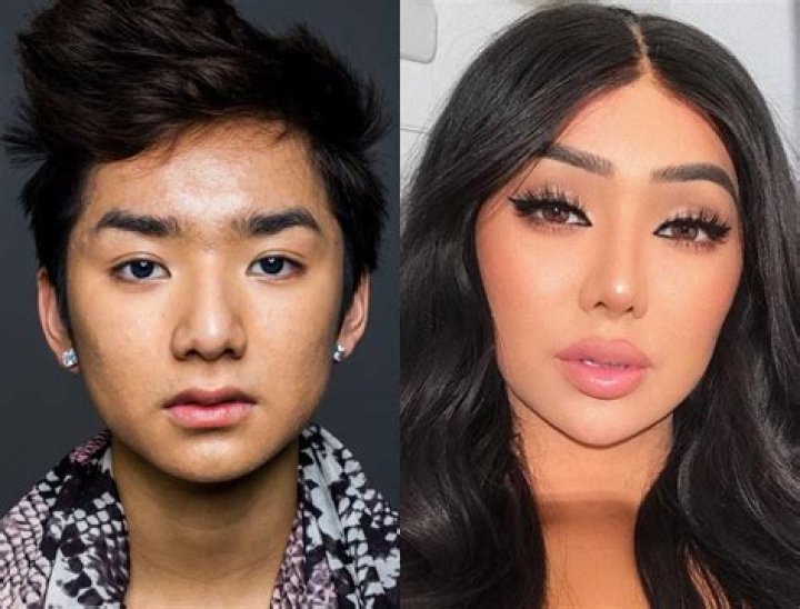 What Happened To Nikita Dragun? Before And After Surgery