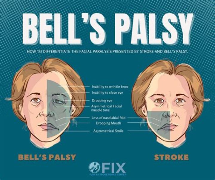 Whats Wrong With Tom Guiry Face? Is It Bells’ Palsy Or Did The Unforgivable Actor Have A Stroke?