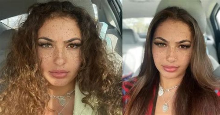 Who Is @Ashaley.Nucole On TikTok? Ash Kaash Before Surgery Pictures