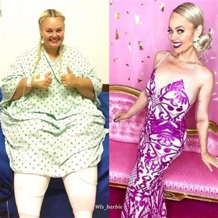 Who Is Kayla Lavender? Weight Loss Barbie TikTok Before and After