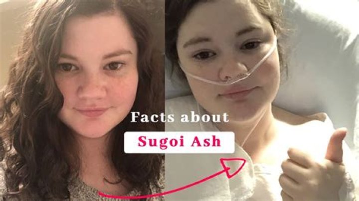 Who Is Sugoi Ash From Twitch? Face Reveal, Age, Wiki, Biography, Instagram