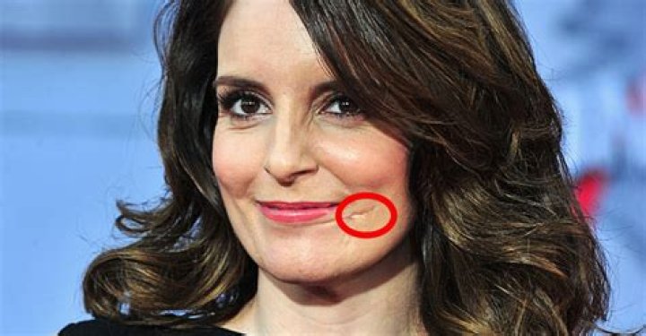 Wikipedia: The Story Behind Tina Fey’s Scar on Her Face